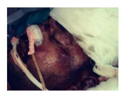 I'm left with no one in the Family, need your support to get recover
