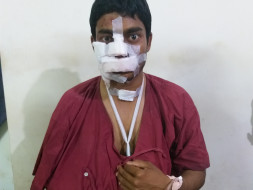 Help Ankush Recover From An Accident