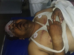 Help Manoj to survive Road Accident