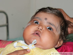 Help My Baby Fight Griscelli Syndrome