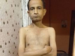 Help Saurabh For Dialysis And Kidney Transplant mother not supporting