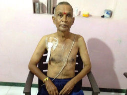 Help Me For Kidney Transplant