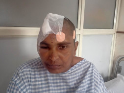 Help Latha Who's Fighting With Brain Tumour And Cancer