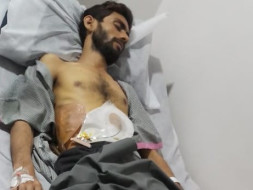 Help my brother recover from Liver disease and Brain Fever