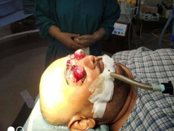 Support Anup Roy To Recover