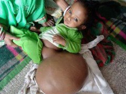 Help Bhavisyawani Fight Tumor