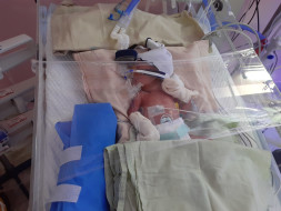 Help Gayathri's on her High risk twin pregnancy with IUGR type 2