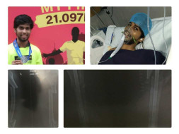 Support Yogesh to recover from accident