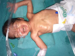 Help premature baby of Kaushal survive NICU journey
