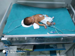 Jyoti's New Born Baby Fights For Each Breath