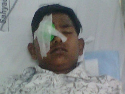 Help Abhay Undergo Removal Of Foreign Object From His Eye's