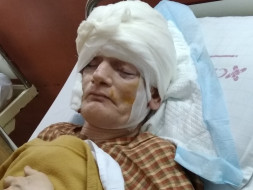 Help Hari Fight Rarest Cancer