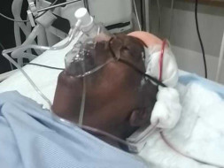 Support My Father Recover From Brain Hemorrhage And Right Body Stroke