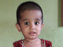 Help little Mishkat Undergo Cochlear Implantation Surgery