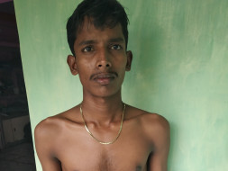 Help My Brother Spinal Neuro Surgery and Kidney Problem