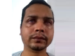 Help Premsingh Undergo An Eye Operation