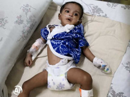 Help My Baby Undergo oesophagel with congenital heart disease