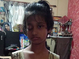 Help My Daughter Undergo Eye Cancer