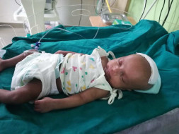 Help BABY recovery from cerebral Abscess