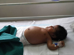 Help 2-month-old Baby Recover From Skin Cancer