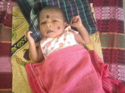 Save 24 Days Old Baby With Heart Complication