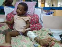 Help Nilasha Fight Cancer And Get Back A Healthy Smile