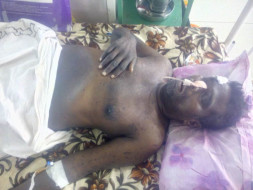 Help Johny Asari for surgery