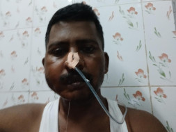 Help Anwar Fight Oral Cancer