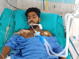 Help Sandipon From acute respiratory distress syndrome and cerebral ma