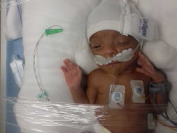 Plz Help My Twin Babies Recovery, Born Prematurely. Plz support π π