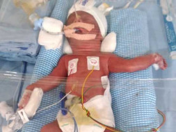 Support My Baby Recovery, Born Prematurely.