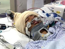help mishra for bone marrow transplant