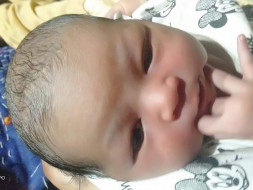 Help Palak Kumar Fight Acynotic Congenital Heart Disease