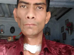 Help Ashok Recover From Mouth Cancer