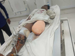 Help Sachin Who Met With A Severe Road Accident.