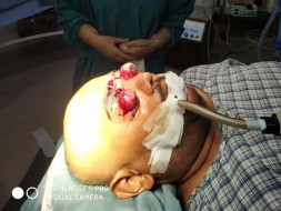 Anup needs your help