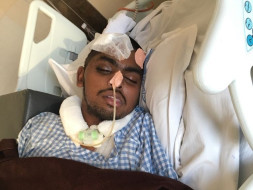 Emergency need for cosmetic bone surgery - SAVE HARI'S LIFE