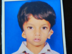 Help Tejas Hear And Speak