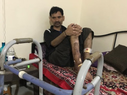 Please Help Vijay By Bringing him back to his Normal Life.