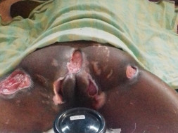 Please help me for Medical Needs