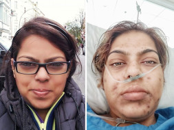 Help Priyanka Undergo Multiple Organ Transplant