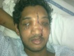 Help Melwyn Recover From His Accident