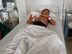 Help 12 Years Old Rudra Recover From A Major Accident