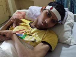 Help Mallikarjuna Live A Normal Life