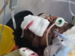 Help My Friend Undergo Brain Surgery And Plastic Surgery To Recover.