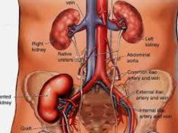 Help Subhash Kumar Choudhary Undergo Kidney Transplant