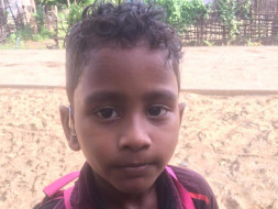 Help Siril To Get Ear Surgery
