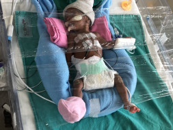 Support To Save Baby Of Nagavalli!