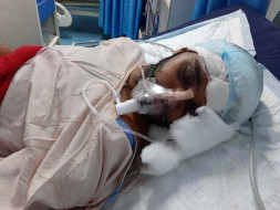 Matloop Head Surgery Needs For Help Urgently
