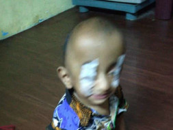 15-month-old Baby Suhail Life Can Be Changed With An Urgent Surgery.